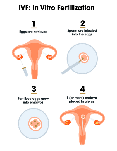 Fellow | Fertility options for your stored sperm